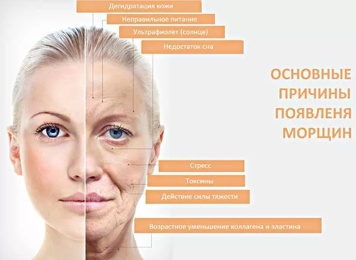 Путеводитель по борьбе с глубокими морщинами: 6 советов, чтобы сделать время своим союзником
